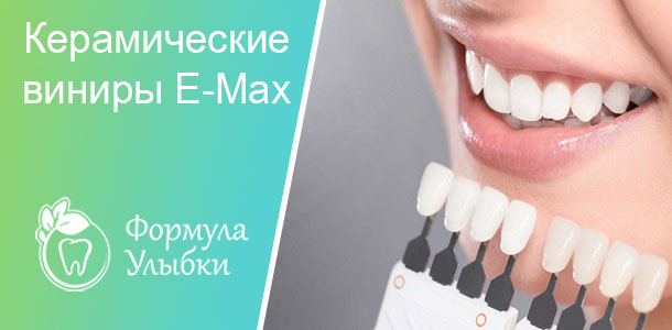 Керамические виниры E-Max в Казани. Опытные врачи клиники «Формула Улыбки» качественно оказывают стоматологические услуги по оптимальной цене