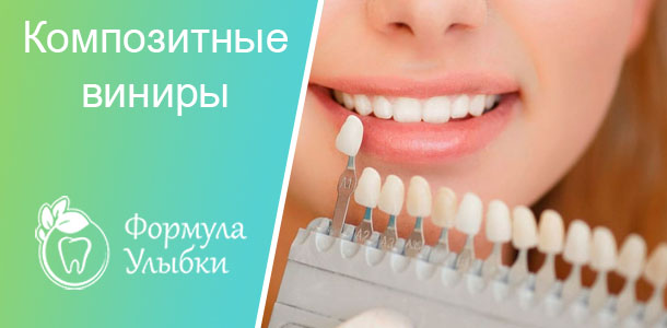 Композитные виниры в Казани. Опытные врачи клиники «Формула Улыбки» качественно оказывают стоматологические услуги по оптимальной цене