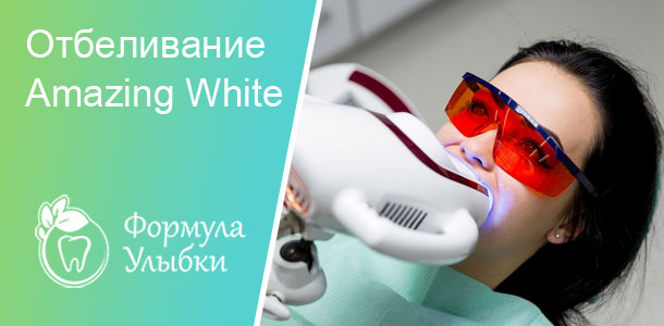 Отбеливание зубов Amazing White в Казани. Опытные врачи клиники «Формула Улыбки» качественно оказывают стоматологические услуги по оптимальной цене