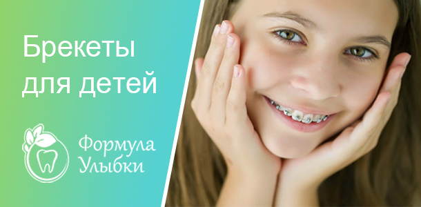 Брекеты для детей в Казани. Опытные врачи клиники «Формула Улыбки» качественно оказывают стоматологические услуги по оптимальной цене