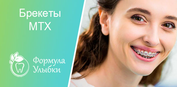 Установка брекетов MTX в Казани. Опытные врачи клиники «Формула Улыбки» качественно оказывают стоматологические услуги по оптимальной цене