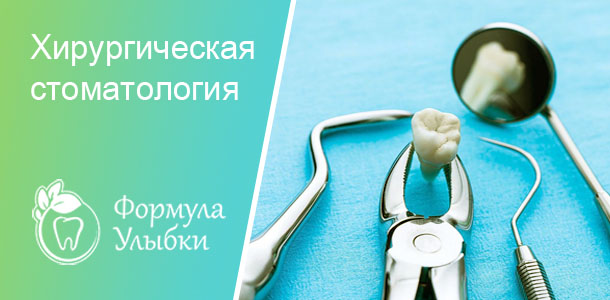 Хирургическая стоматология в Казани. Опытные врачи клиники «Формула Улыбки» качественно оказывают стоматологические услуги по оптимальной цене