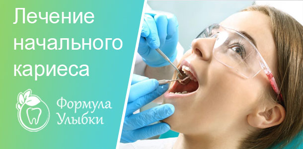 Лечение кариеса эмали в Казани. Опытные врачи клиники «Формула Улыбки» качественно оказывают стоматологические услуги по оптимальной цене