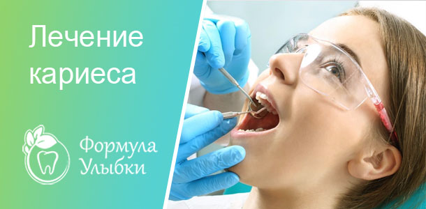 Лечение кариеса в Казани. Опытные врачи клиники «Формула Улыбки» качественно оказывают стоматологические услуги по оптимальной цене