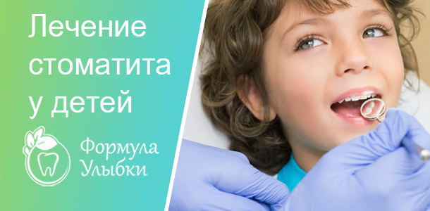 Лечение стоматита в Казани. Опытные врачи клиники «Формула Улыбки» качественно оказывают стоматологические услуги по оптимальной цене