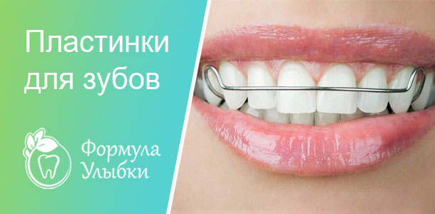 Пластины для зубов в Казани. Опытные врачи клиники «Формула Улыбки» качественно оказывают стоматологические услуги по оптимальной цене