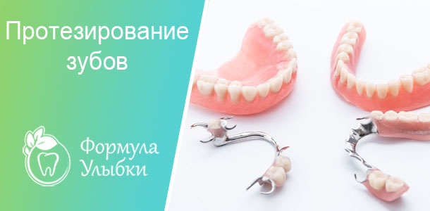 Протезы зубов в Казани. Опытные врачи клиники «Формула Улыбки» качественно оказывают стоматологические услуги по оптимальной цене