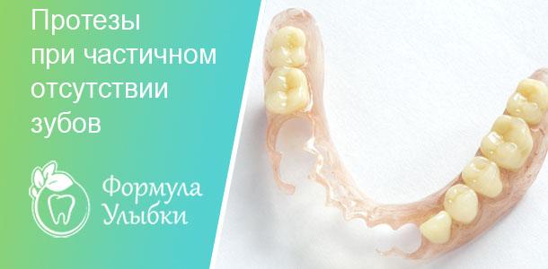 Протезы при частичном отсутствии зубов в Казани. Опытные врачи клиники «Формула Улыбки» качественно оказывают стоматологические услуги по оптимальной цене