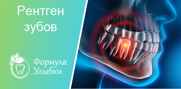 Рентген зубов в Казани. Опытные врачи клиники «Формула Улыбки» качественно оказывают стоматологические услуги по оптимальной цене