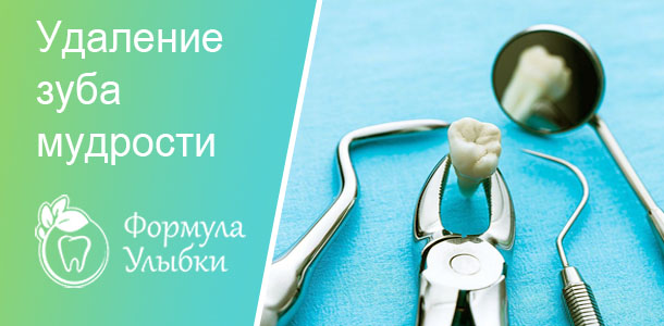 Удаление зуба мудрости в Казани. Опытные врачи клиники «Формула Улыбки» качественно оказывают стоматологические услуги по оптимальной цене
