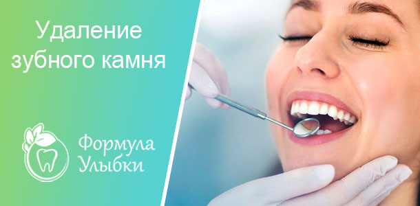 Снятие зубного камня в Казани. Опытные врачи клиники «Формула Улыбки» качественно оказывают стоматологические услуги по оптимальной цене