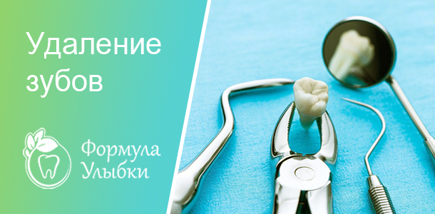 Удаление зубов в Казани. Опытные врачи клиники «Формула Улыбки» качественно оказывают стоматологические услуги по оптимальной цене